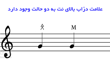 علامت دراب بالاي نت به دو حالت وجود دارد